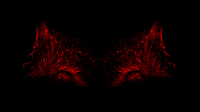 A symmetrical growth of red cells growing in tendrils reminiscent of wings