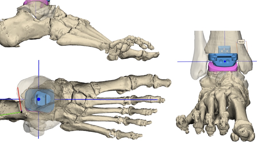 restor3d planning image